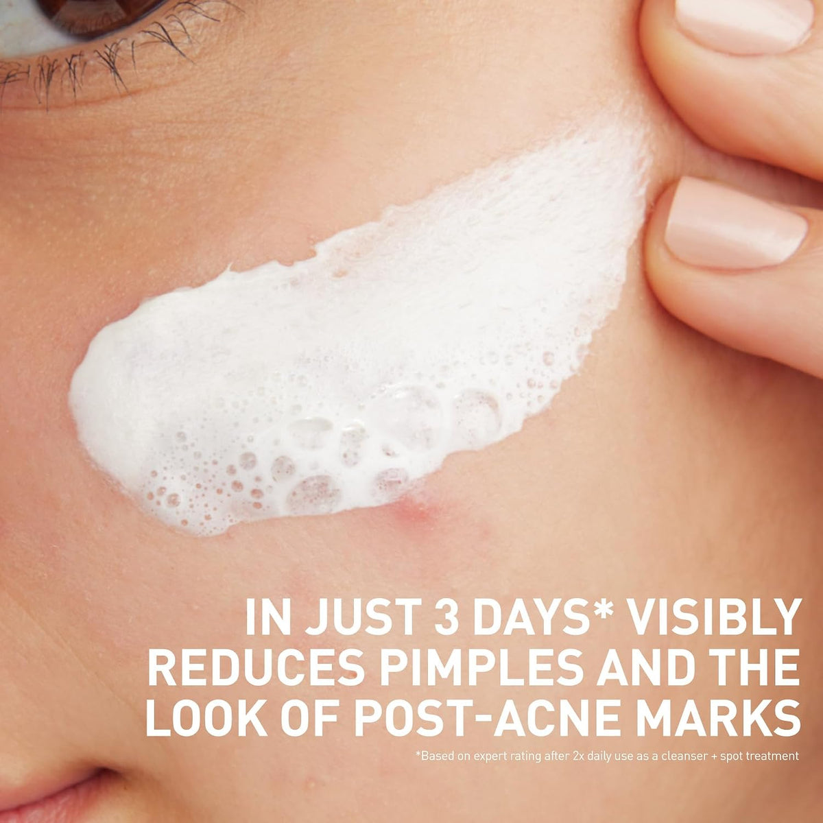 CeraVe Clay to Foam Acne Face Wash. Salicylic Acid Spot Treatment. 4 Oz | 3-In-1 Kaolin Clay Mask and Foaming Facial Cleanser with Glycerin and Ceramides Acts As a Blackhead Remover To Clear Acne
